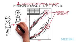 Pediatrics – Stature Abnormalities By Kyle McNerney MD [upl. by Atinehc867]