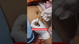 how to administer subcutaneous injection nursingofficer mbbs trendingshort shortsfeed nursing [upl. by Anitsirk]