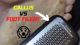 CALLUS VS FOOT FILER Pt 1 [upl. by Yeslehc]