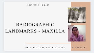 Lecture 2 Anatomical landmarks of Maxilla [upl. by Towrey]