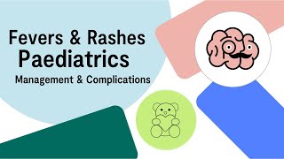 UKMLA AKT Paediatrics Fevers and Rashes  Diagnosis and Management  Multiple Choice Questions [upl. by Vtarj]