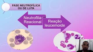 Reação leucemoide x Neutrofilia Reacional [upl. by Arsi]