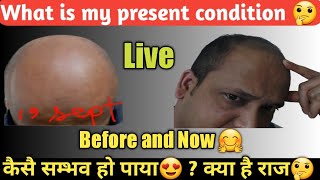 What is my present condition after long time use of Neo Hair Lotion 🤔 [upl. by Wye478]