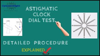 Astigmatic Clock Dial Test Detailed Procedure and Principle [upl. by Girvin]