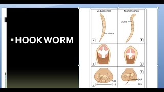 Parasitology 200 a Hookwormancylostoma duodenalenecator americanus [upl. by Litnahs]