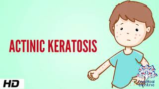 Actinic keratosis Causes Signs and Symptoms Diagnosis and Treatment [upl. by Suzi]