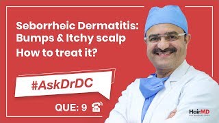 How To Treat Seborrheic Dermatitis कैसे seborrheic का इलाज करे  AskDrDc Ep 9  In HINDI [upl. by Firahs]