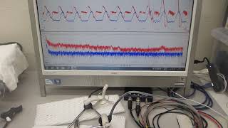 基礎実験ーー低周波刺激で高周波を制御する超音波技術ーー（超音波システム研究所） [upl. by Sidwel967]