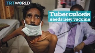 Tuberculosis needs a new vaccine [upl. by Worlock42]