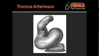 Truncus Arteriosus [upl. by Lawlor]