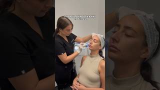 From Skin Assessment to Radio Frequency Microneedling at Dr Medispa Knightsbridge [upl. by Merilee219]