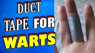 How To Remove Warts amp Verrucas Using Duct Tape [upl. by Arim]