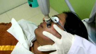 Fractional Erbium YAG Laser Treatment for Acne Scars  Dr Rinky Kapoor [upl. by Losiram]