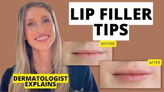 Dermatologist Shares 9 Lip Filler Tips to Know Before and After Treatment [upl. by Irtimed]