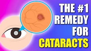 1 REMEDY for Cataracts in 2024 Updated [upl. by Jorrie]