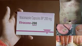 Itraconazole Capsule💊 Bp 200100mgUse Dose Side Effects and Price in Hindi  Anti Fungal Drug [upl. by Ielak]