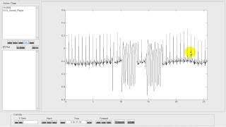 MATLABdigiscope ECG Sound Player [upl. by Omrellig]