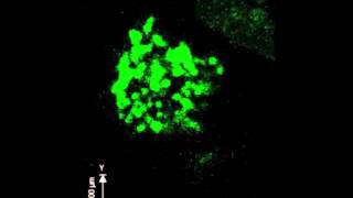 Scientists catch natural killer Tcell attacking disease cell on video [upl. by Sudoeht]