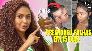 APENAS TRÊS INGREDIENTES O CABELO CRESCE MUITO E NÃO CAI NÃO USE MUITO [upl. by Biron]