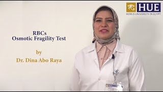 RBCs Osmotic Fragility Test [upl. by Anifesoj]