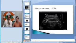 Understanding the Biophysical Profile Assessing Fetal Health during Pregnancy [upl. by Nepil839]