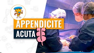 Appendicite acuta tutto quello che devi sapere  Acute care surgery ft surgicalpizza652 [upl. by Memberg840]