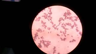 Staphylococcus haemolyticus [upl. by Notlrac]