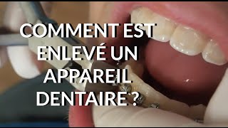 Comment est enlevé un appareil dentaire  Appareildentaireinfo [upl. by Nalyad]