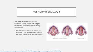 Common Perioperative Complications Keyword Review  Dr Green [upl. by Nicola]