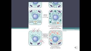 Parenchymal Stromal  Vascular Dystrophiesamp Mixed DystophiesCalcification pathology [upl. by Spracklen491]