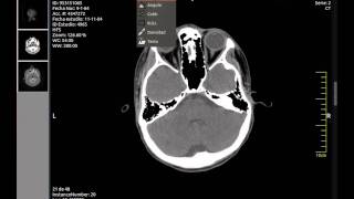 Multiplatform Dicom Viewer [upl. by Drandell]