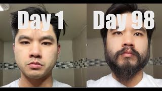 I Grew Out My Beard For 3 Months Using Minoxidil Rogaine [upl. by Assilen]