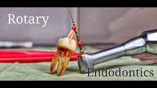 Rotary Endodontics [upl. by Antonio136]