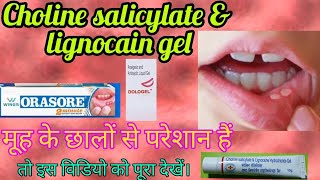 Mouth Ulcer gel choline sacilylate amp lignocain hcl gel use dosage precaution in hindi [upl. by Morell900]