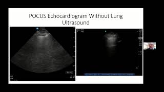 Webinar Point of Care Echocardiography in Critical Care [upl. by Janenna914]