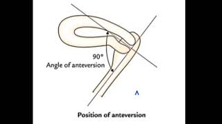 Concept Of Anteverted amp Anteflexed Uterus [upl. by Siesser619]