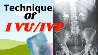 Technique of IVUIVP Ep36 Intravenous urogrampyelogram Procedure of IVUIVP test [upl. by Bibbye479]