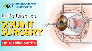 Squint surgery in indore  Best squint treatment in indore [upl. by Yates]