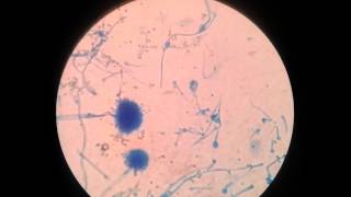 Vegetative forms of fungi ie yeast cell budding pseudohypha aseptate and septate hyphae [upl. by Ttenaj]