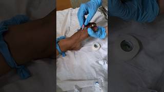 IV cannula insertion theprettynurse nursingofficer healthcareprofessionals medicalprofession [upl. by Nowujalo14]