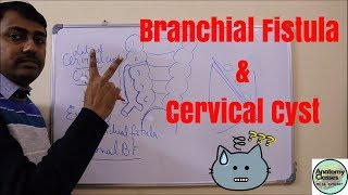 Embryological basis of Cervical cyst sinus and Branchial fistula [upl. by Sirad]