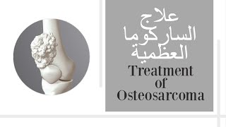 علاج الساركوما العظمية  علاج سرطان العظم Treatment of Osteosarcoma [upl. by Ahsemaj]