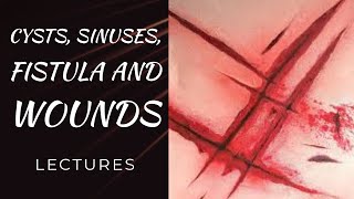 CYSTS SINUSES FISTULA WOUNDS lecture 3 FISTULA and ENTEROCUTANEOUS FISTULA all MCQs needed for exa [upl. by Haym]