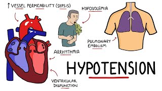 Causes of Hypotension  What causes Low Blood Pressure with Signs and Symptoms [upl. by Attevaj641]