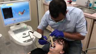 CEREC Ortho Scan tips and tricks [upl. by Ciapas]