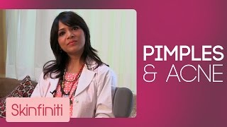 How To Get Rid Of Pimples amp Acne  Skincare  Skinfiniti With DrJaishree Sharad [upl. by Ssew]