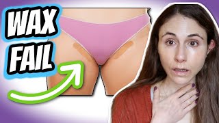 How to prevent HAIR WAXING FAILS  bumps breakouts redness ingrown hairs burns Dr Dray [upl. by Troc838]