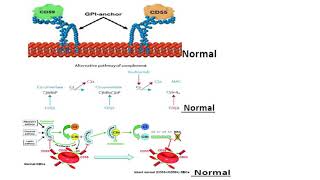 Paroxysmal nocturnal hemoglobinuria 1 [upl. by Niliac310]