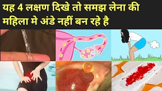 ये 4 लक्षण बताते है की महिला मे अंडे नही बन रहे।Anovulation symptoms in hindi । [upl. by Urbai932]