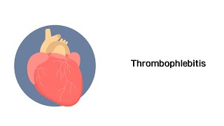 Thrombophlebitis  Erkrankungen der Gefäße und des Kreislauf [upl. by Krik]